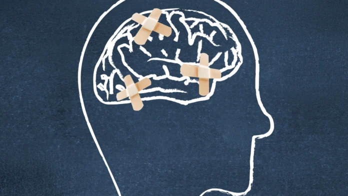 A chalk drawing of a brain with bandages on it, signifying the effects of trauma therapy